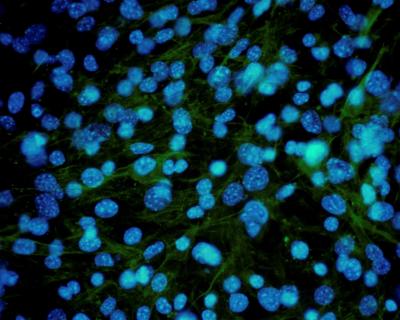 Fibroblasts Web 1 