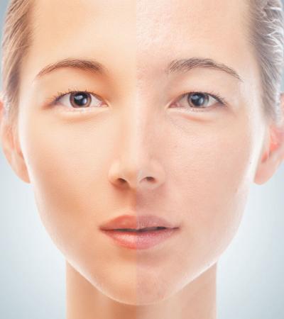 Top 38 Home Remedies For Dry Skin On Face 1 1 